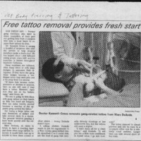 CF-20180120-Free tattoo removal provides fresh sta0001.PDF
